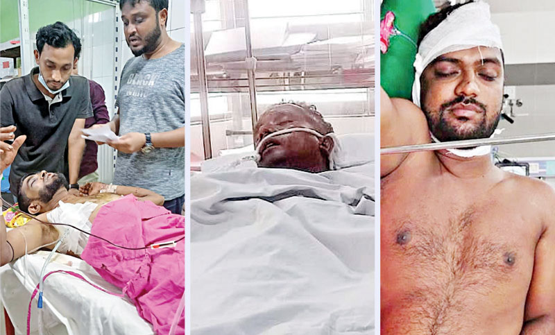 পুলিশের দুই মামলায় আসামি ৬৭৫ ছাত্রদল নেতা লাইফ সাপোর্টে